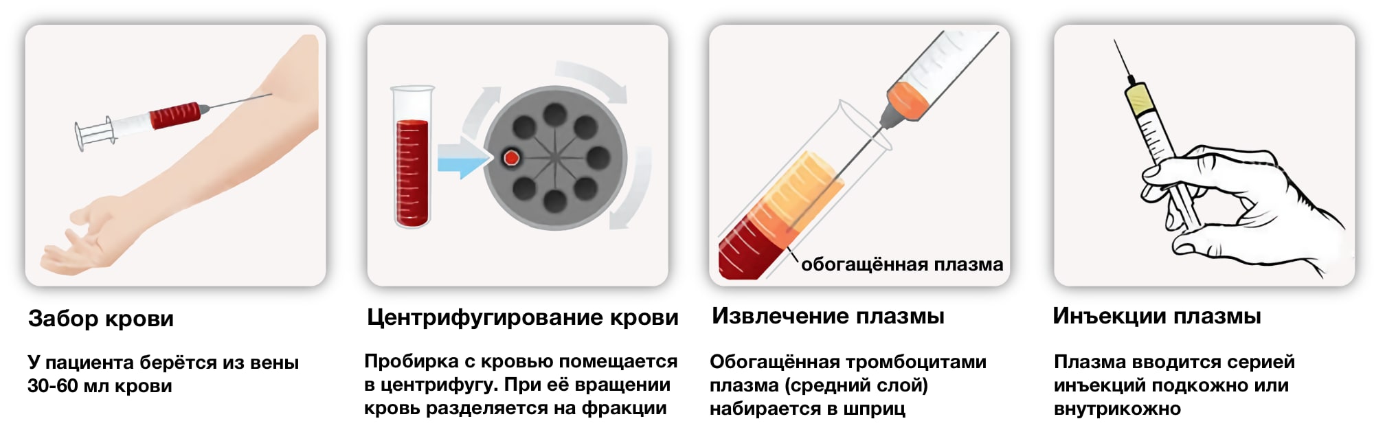 Плазмолифтинг